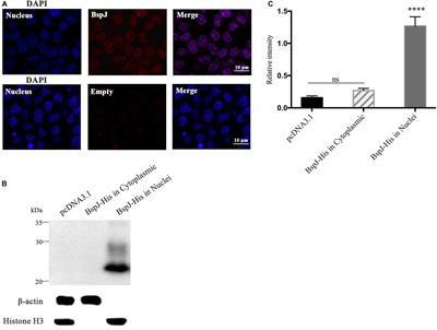 Brucella abortus BspJ Is a <mark class="highlighted">Nucleomodulin</mark> That Inhibits Macrophage Apoptosis and Promotes Intracellular Survival of Brucella